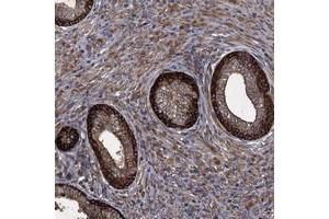 Immunohistochemical staining of human prostate with TXNDC11 polyclonal antibody  shows distinct cytoplasmic positivity in glandular cells.