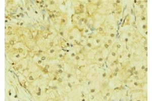 ABIN6272852 at 1/100 staining Mouse liver tissue by IHC-P. (DACH1 antibody  (Internal Region))