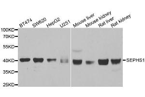 Western blot analysis of extracts of various cell lines, using SEPHS1 antibody. (SEPHS1 antibody  (AA 1-392))