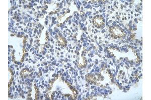 Rabbit Anti-TRA2B Antibody       Paraffin Embedded Tissue:  Human alveolar cell   Cellular Data:  Epithelial cells of renal tubule  Antibody Concentration:   4. (TRA2B antibody  (Middle Region))