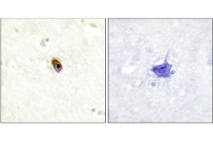Immunohistochemistry analysis of paraffin-embedded human brain tissue using AurB/C (Phospho-Thr236/202) antibody. (Aurora Kinase C antibody  (pThr202, pThr236))