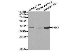 MEK1 antibody  (AA 1-100)