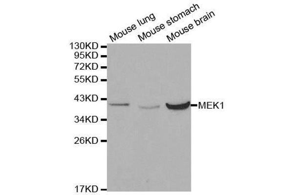 MEK1 anticorps  (AA 1-100)
