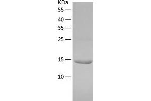 Western Blotting (WB) image for Tripartite Motif Containing 24 (TRIM24) (AA 896-1014) protein (His tag) (ABIN7284349) (TRIM24 Protein (AA 896-1014) (His tag))