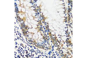 Immunohistochemistry of paraffin-embedded human colon using CCDC124 antibody  at dilution of 1:100 (40x lens).