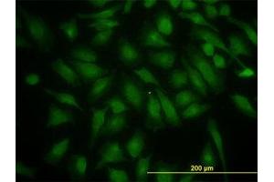 Image no. 1 for anti-Phosphoinositide 3-kinase Regulatory Subunit 4 (PIK3R4) (AA 1259-1359) antibody (ABIN599234) (PIK3R4 antibody  (AA 1259-1359))