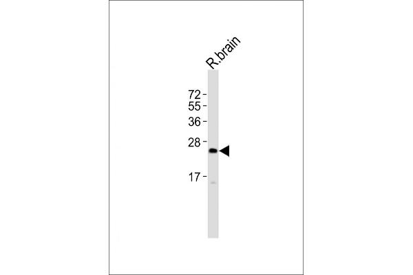 Uroplakin 2 antibody