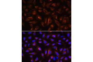 Immunofluorescence analysis of U-2 OS cells using B antibody (ABIN6130859, ABIN6137109, ABIN6137110 and ABIN6220869) at dilution of 1:100. (ARL13B antibody  (AA 1-240))