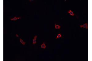 ABIN6269379 staining PC12  cells by IF/ICC. (STX1A antibody  (N-Term))