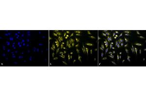 Immunocytochemistry/Immunofluorescence analysis using Rabbit Anti-KDEL Polyclonal Antibody (ABIN863187 and ABIN863188). (KDEL antibody)