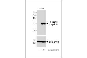 Western blot analysis of lysates from Hela cell line, untreated or treated with nocodazole(1 μg/mL, 18h), using Phospho-HIST1H3B3(S10) Antibody (upper) or Beta-actin (lower).