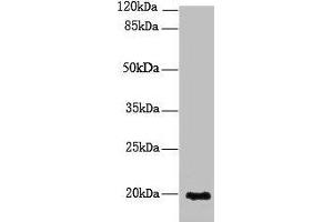 Western blot All lanes: NUDT11 antibody at 2 μg/mL + U251 whole cell lysate Secondary Goat polyclonal to rabbit IgG at 1/10000 dilution Predicted band size: 19 kDa Observed band size: 19 kDa (NUDT11 antibody  (AA 1-164))