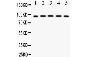 Anti- NR3C1 antibody, Western blotting All lanes: Anti NR3C1  at 0. (Glucocorticoid Receptor antibody  (AA 1-373))