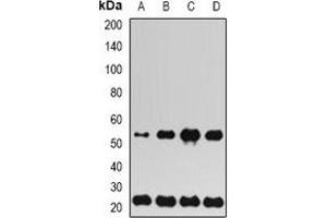 Western blot analysis of UBE2H expression in SW480 (A), SKOV3 (B), mouse liver (C), rat lung (D) whole cell lysates. (UBE2H antibody)