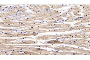 Detection of CTGF in Rabbit Cardiac Muscle Tissue using Polyclonal Antibody to Connective Tissue Growth Factor (CTGF) (CTGF antibody  (AA 118-388))