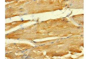 Immunohistochemistry of paraffin-embedded human skeletal muscle tissue using ABIN7143040 at dilution of 1:100