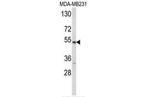 Western blot analysis of CYP2A13 Antibody (C-term) in MDA-MB231 cell line lysates (35ug/lane). (CYP2A13 antibody  (C-Term))