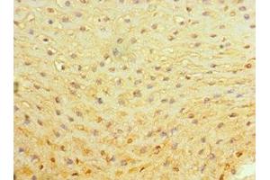 Immunohistochemistry of paraffin-embedded human esophagus tissue using ABIN7142595 at dilution of 1:100