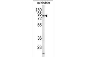 Western blot analysis of STRA6 Antibody (C-term)  in mouse bladder tissue lysates (35 μg/lane). (STRA6 antibody  (C-Term))
