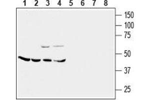 Western blot analysis of mouse brain membrane (lanes 1 and 5), rat cerebellum (lanes 2 and 6), rat lung (lanes 3 and 7) and rat kidney (lanes 4 and 8) lysates: - 1-4. (CRHR2 antibody  (Extracellular))