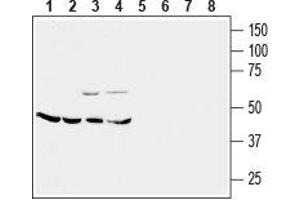 Western blot analysis of mouse brain membrane (lanes 1 and 5), rat cerebellum (lanes 2 and 6), rat lung (lanes 3 and 7) and rat kidney (lanes 4 and 8) lysates: - 1-4. (CRHR2 antibody  (Extracellular, N-Term))