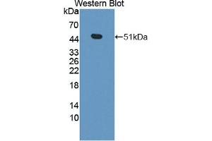 Detection of Recombinant CPA3, Mouse using Polyclonal Antibody to Carboxypeptidase A3 (CPA3)