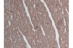 Detection of SHBG in Rat Cardiac Muscle Tissue using Monoclonal Antibody to Sex Hormone Binding Globulin (SHBG) (SHBG antibody  (AA 222-358))