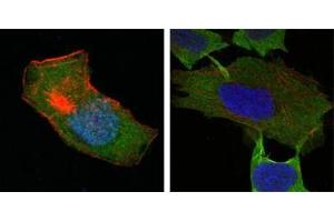 Confocal immunofluorescence analysis of HepG2 (left) and L-02 (right) cells using GSTP1 antibody (green). (GSTP1 antibody)
