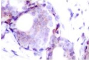 Image no. 1 for anti-Myc Proto-Oncogene protein (MYC) (pSer373) antibody (ABIN318072) (c-MYC antibody  (pSer373))