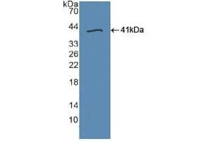 Western blot analysis of recombinant Human TLR9. (TLR9 antibody  (AA 28-362))