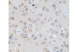 Immunohistochemistry of paraffin-embedded Rat brain using UBE2A Polyclonal Antibody (UBE2A antibody)