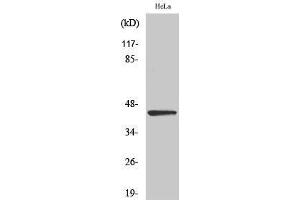 Western Blotting (WB) image for anti-Endonuclease VIII-Like 1 (NEIL1) (C-Term) antibody (ABIN3176258) (NEIL1 antibody  (C-Term))