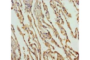 Immunohistochemistry of paraffin-embedded human lung tissue using ABIN7149965 at dilution of 1:100 (FMO5 antibody  (AA 1-285))