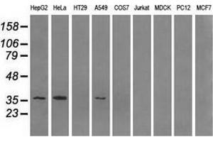 Western blot analysis of extracts (35 µg) from 9 different cell lines by using anti-AKR1A1 monoclonal antibody. (AKR1A1 antibody)