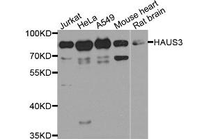 Western blot analysis of extracts of various cell lines, using HAUS3 antibody (ABIN5974538) at 1/1000 dilution. (HAUS3 antibody)