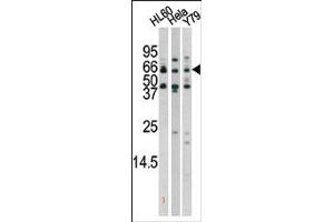 Image no. 2 for anti-RAD9 Homolog A (S. Pombe) (RAD9A) (pSer272) antibody (ABIN358200) (RAD9A antibody  (pSer272))