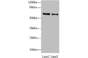 Western blot All lanes: ZNF626 antibody at 10 μg/mL Lane 1: HepG2 whole cell lysate Lane 2: Raji whole cell lysate Secondary Goat polyclonal to rabbit IgG at 1/10000 dilution Predicted band size: 61, 53, 11 kDa Observed band size: 61 kDa (ZNF626 antibody  (AA 1-92))