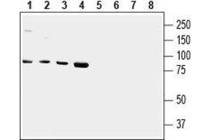 Western blot analysis of human HMC3 microglial (lanes 1 and 5), Jurkat T-cell leukemia (lanes 2 and 6), HepG2 liver hepatoma (lanes 3 and 7) and chronic myelogenous K562 leukemia (lanes 4 and 8) cell lysates: - 1-4. (TRPV2 antibody  (1st Extracellular Loop))