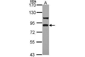 WB Image Sample (30 ug of whole cell lysate) A: Hela 7. (TICAM1 antibody  (C-Term))