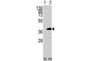 Western blot analysis of PBK (arrow) using PBK polyclonal antibody .