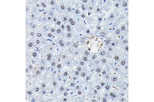 Immunohistochemistry of paraffin-embedded rat liver using C/EBPB Rabbit pAb (ABIN6134025, ABIN6138382, ABIN6138383 and ABIN6213964) at dilution of 1:100 (40x lens). (CEBPB antibody  (AA 150-250))