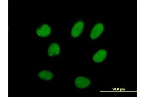 Immunofluorescence of purified MaxPab antibody to ILF2 on HeLa cell.