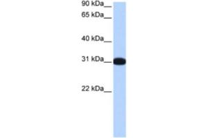 Western Blotting (WB) image for anti-Muscleblind-Like 2 (MBNL2) antibody (ABIN2463438) (MBNL2 antibody)