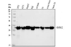 anti-Survival of Motor Neuron 1, Telomeric (SMN1) (AA 22-52), (N-Term) antibody