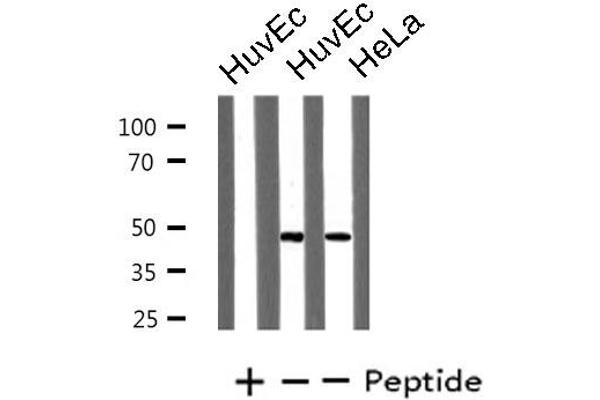 LHX1 antibody  (Internal Region)