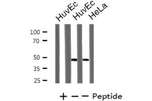 Western blot analysis of extracts from HuvEc/HeLa cells, using LHX1 antibody. (LHX1 antibody  (Internal Region))