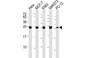 Lane 1: HeLa Cell lysates, Lane 2: MCF-7 Cell lysates, Lane 3: K562 Cell lysates, Lane 4: NIH/3T3 Cell lysates, Lane 5: PC-12 Cell lysates, probed with IF4E (1504CT774. (EIF4E2 antibody)