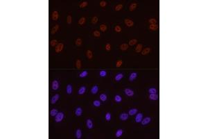 Immunofluorescence analysis of A-549 cells using Phospho-POLR2A CTD-S5 antibody  at dilution of 1:50 (40x lens).