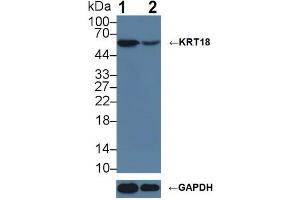 Western blot analysis of (1) Wild-type HeLa cell lysate, and (2) KRT18 knockout HeLa cell lysate, using Rabbit Anti-Mouse KRT18 Antibody (1 µg/ml) and HRP-conjugated Goat Anti-Mouse antibody (abx400001, 0. (Cytokeratin 18 antibody  (AA 1-423))