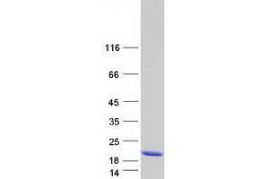 Validation with Western Blot
